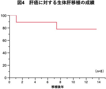 図4　肝癌に対する生体肝移植の成績