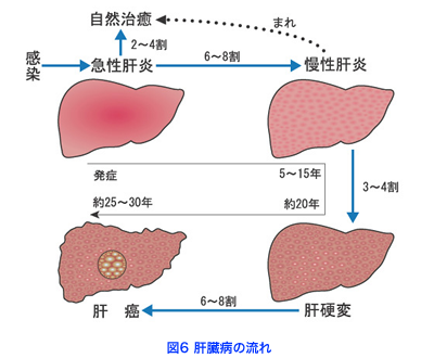 女性 肝臓 病気